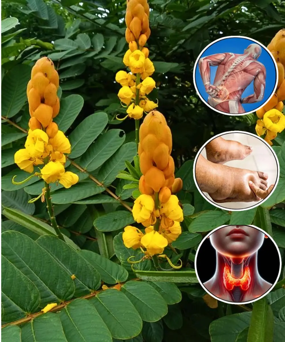 Senna Alexandrina: 7 Benefits and uses