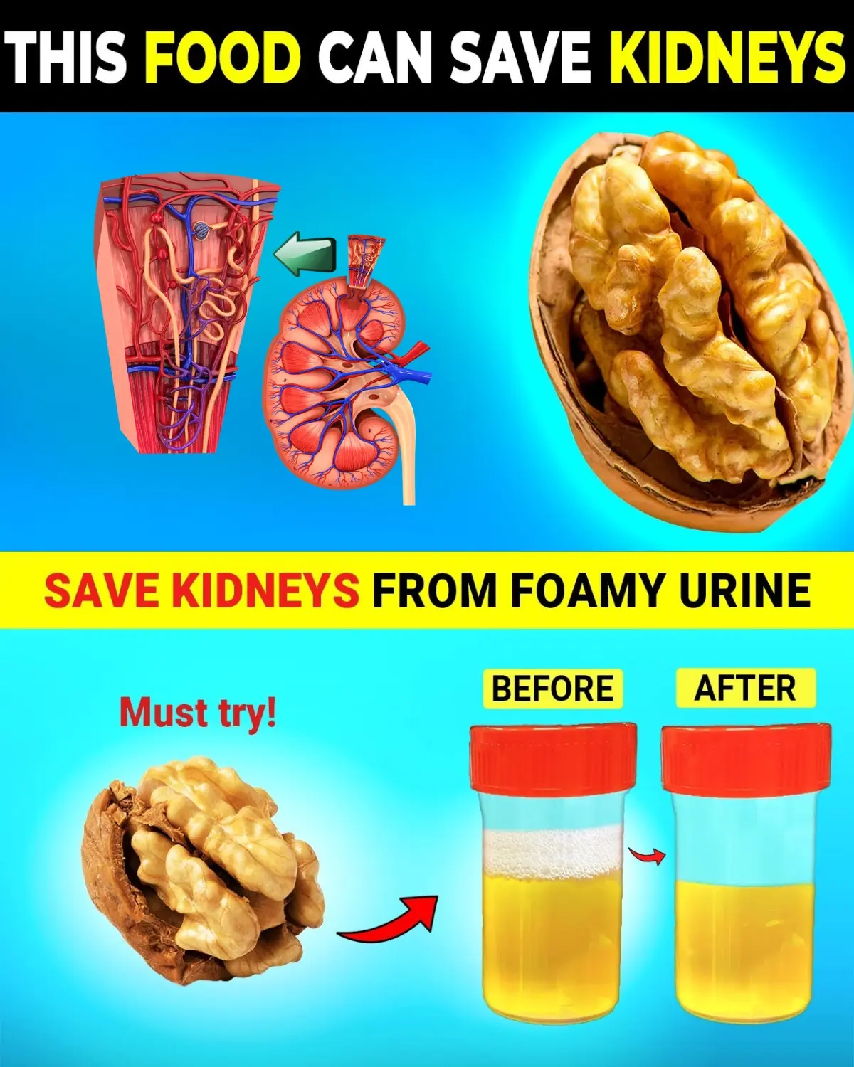 Top 6 Superfoods That May Help Reduce Proteinuria and Support Kidney Health