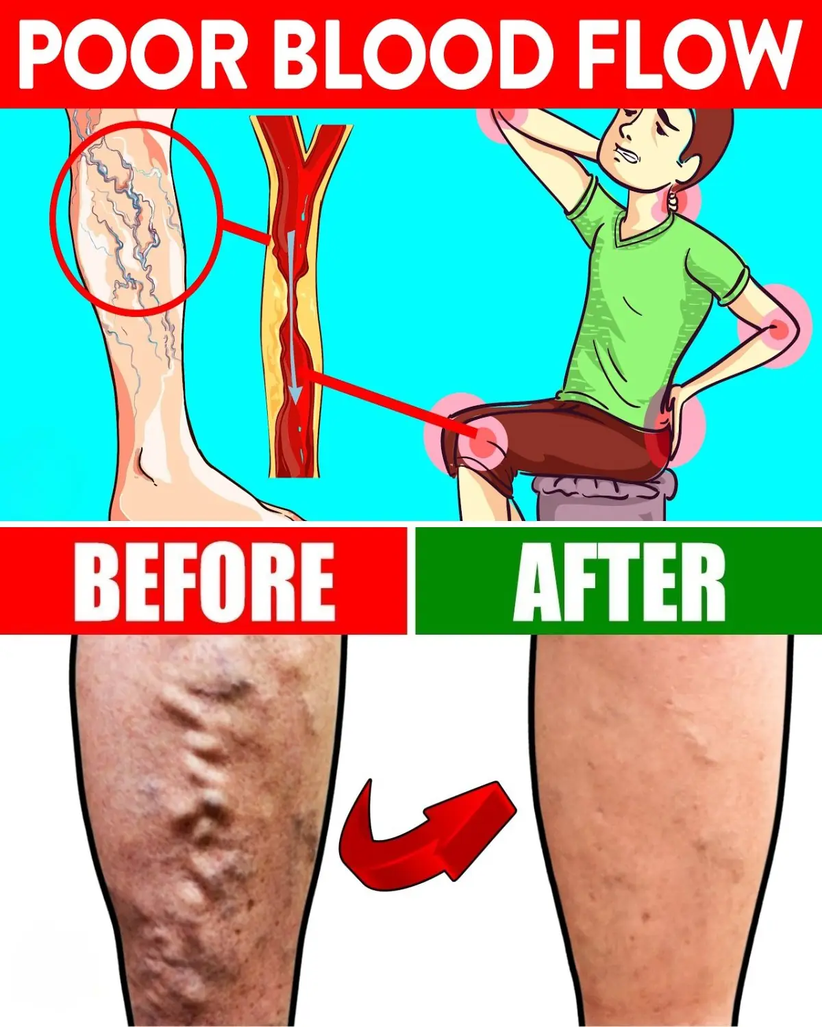 5 Hidden Causes of Poor Blood Circulation