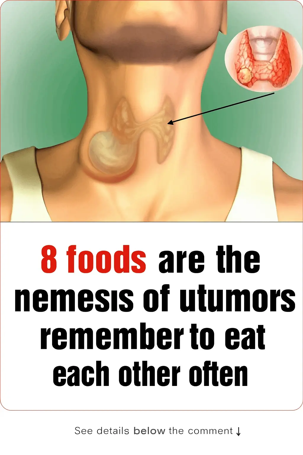 8 Foods That Fight Tumors — Eat Them Regularly