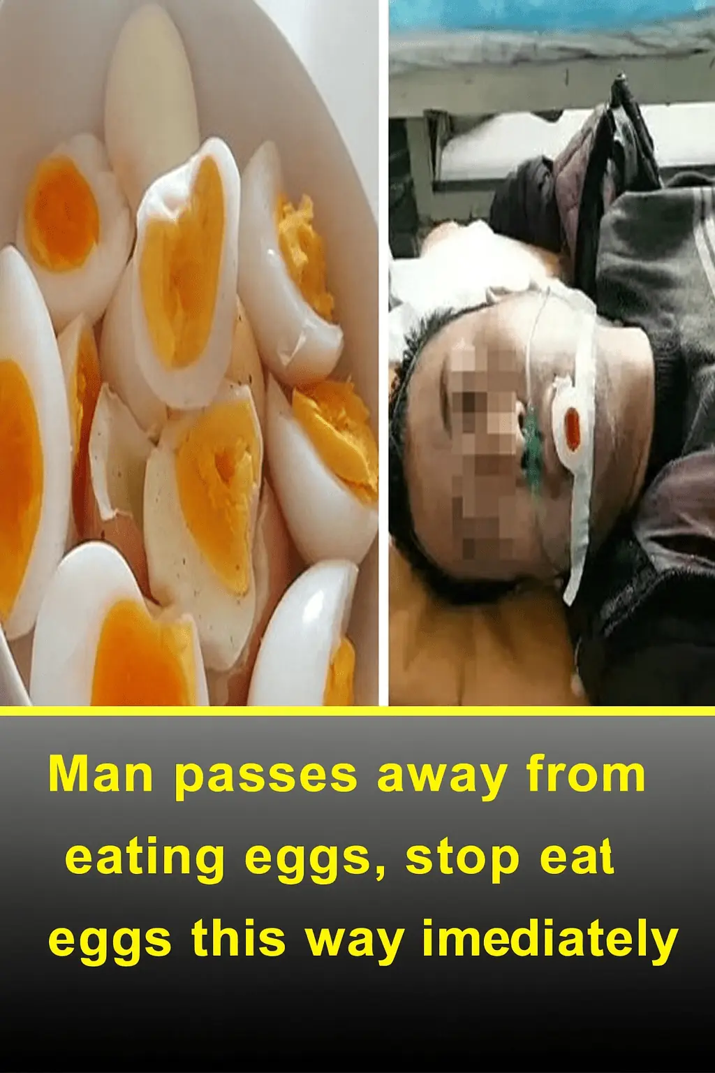 Man Passed Away After Eating Eggs — Stop Eating Eggs This Way Immediately