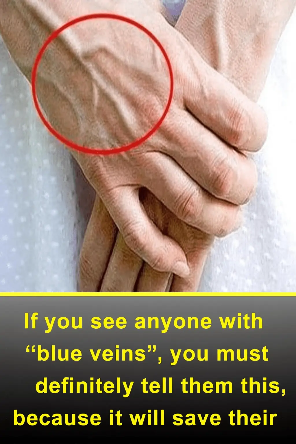 If You See Someone with “Blue Veins,” Tell Them This — It Could Save Their Life