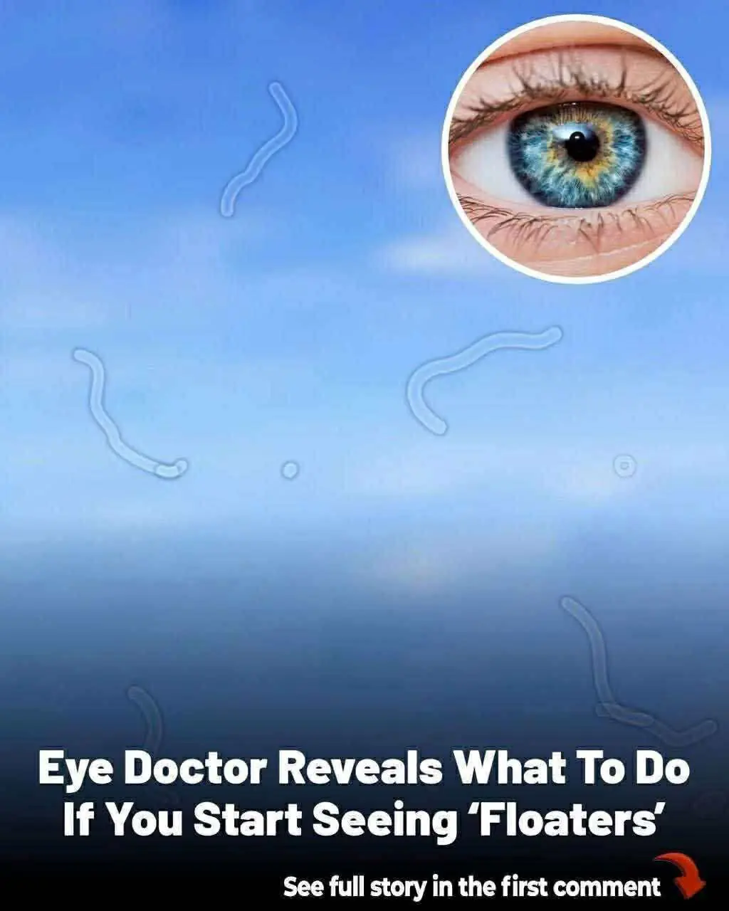 Eye floaters: what they are and what to do if you notice them, according to an eye doctor