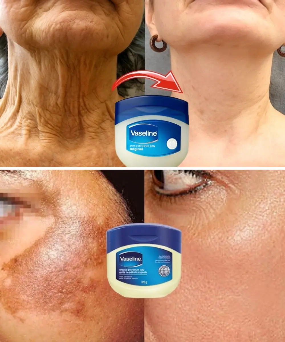This Vaseline Hack Tightens Neck Skin Better Than Expensive Creams