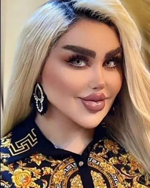 She Had 43 Cosmetic Procedures To Become A Barbie Doll – Critics Say She Looks Like A ‘Zombie’