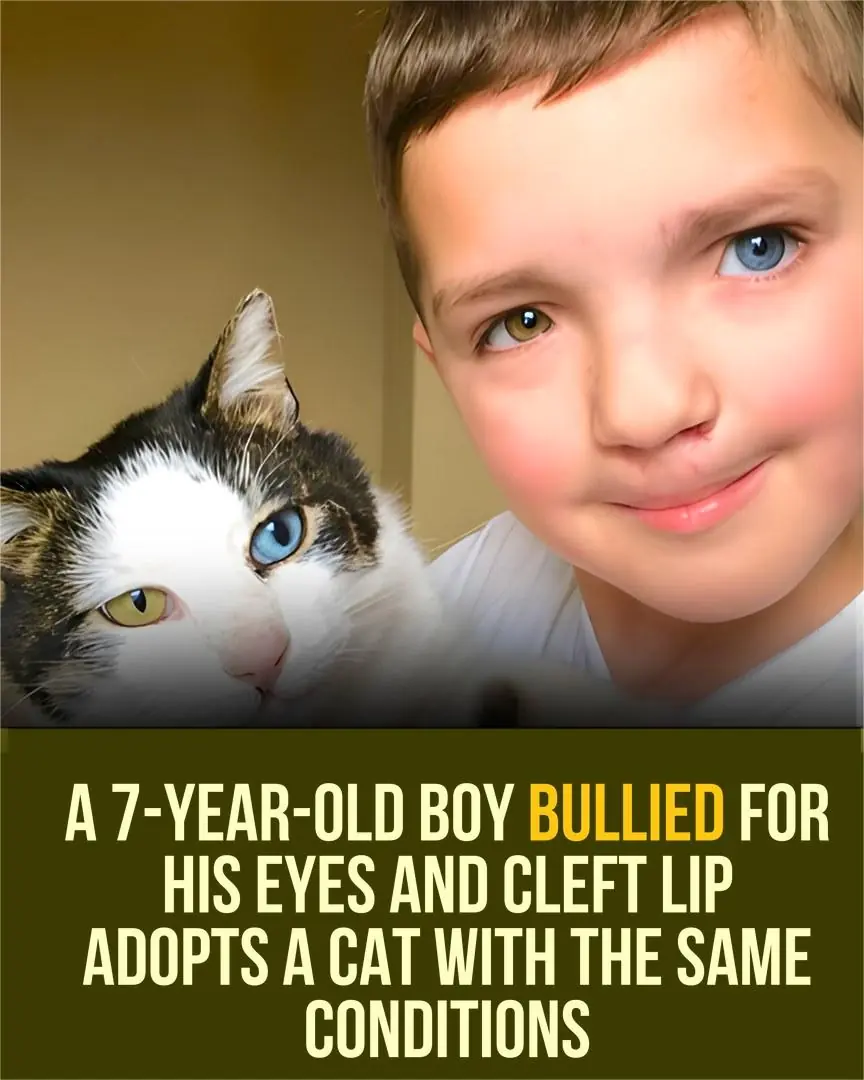 Bullied 7-Year-Old Boy Finds a Kindred Spirit in Cat With the Same Rare Conditions