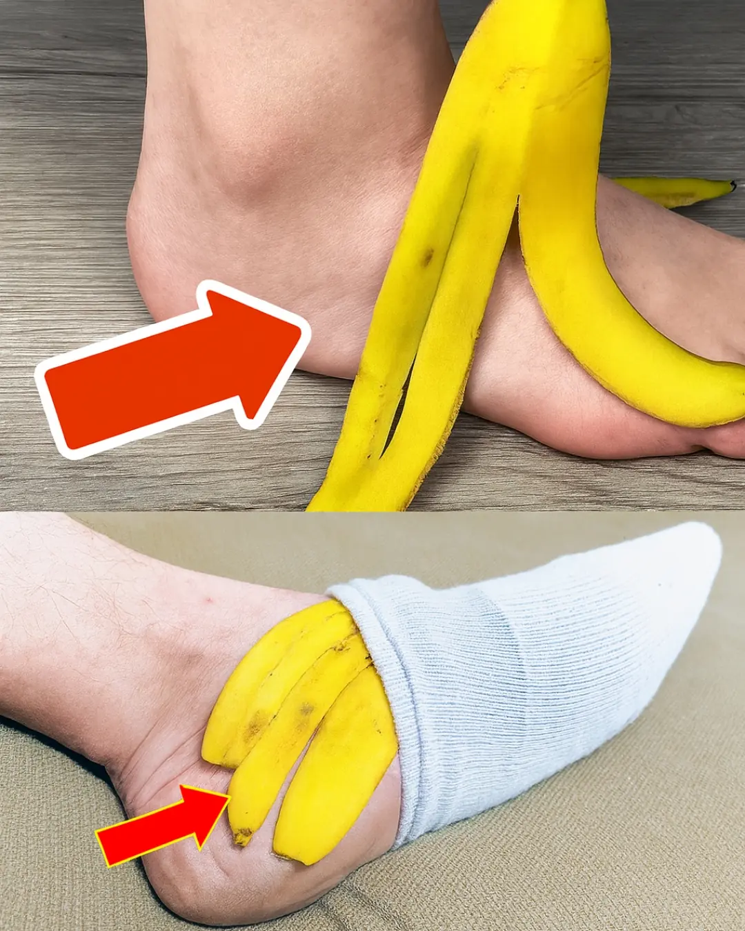 Banana Peel on Your Feet: A Surprising Natural Remedy You’ll Love