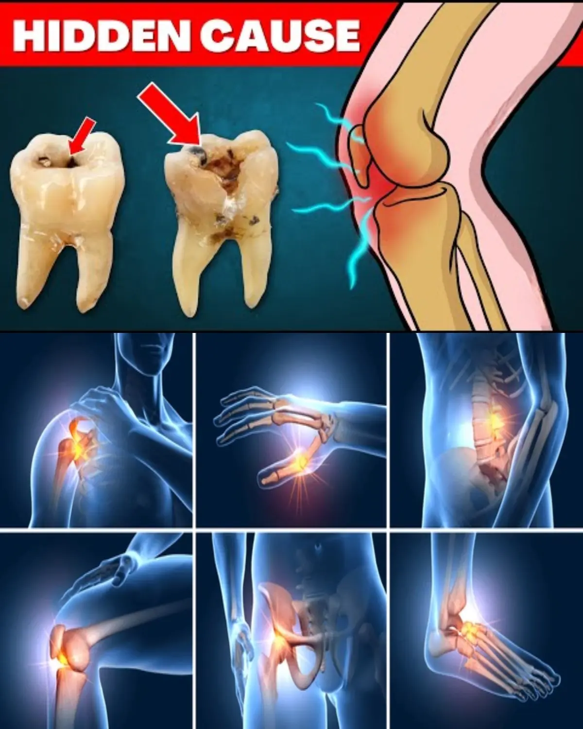 Beware: The Hidden Culprit Fueling Your Arthritis Pain