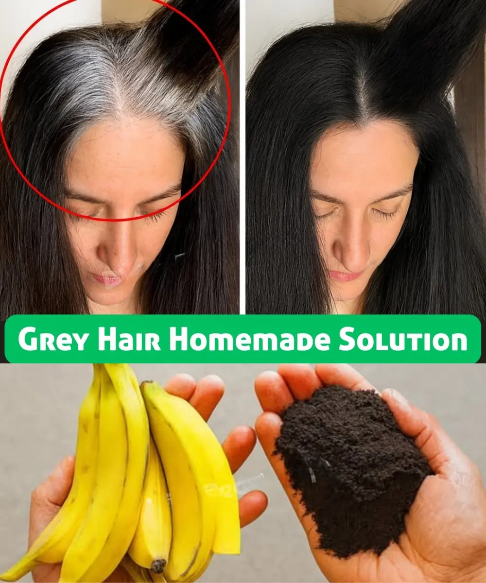 From White Hair to Black Hair Naturally in Just 5 Minutes — Fast Hair Growth Remedy