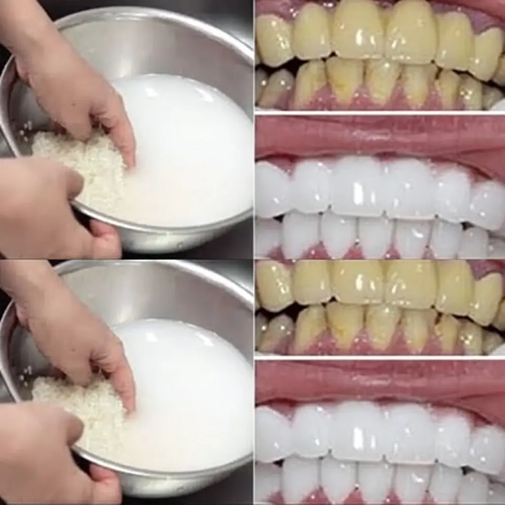Fast Rice Water Trick for a Brighter Smile